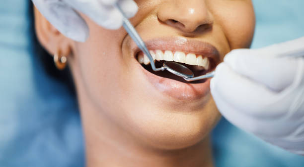 Best Broken or Chipped Tooth Repair in Sage, CA