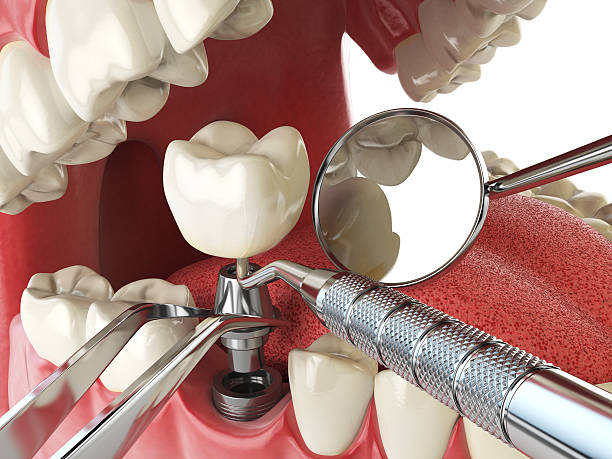 Best 24-Hour Emergency Dental Care in Sage, CA